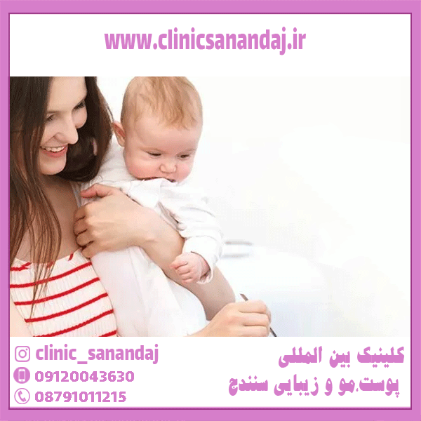 درمان ریزش مو در دوران شیردهی